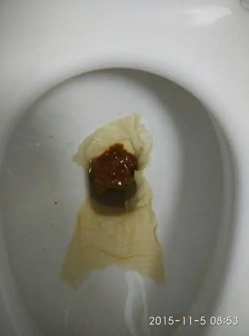 晚上开始大便稀,一直到今天,一天拉好多次,而且肚子有点痛,这是肠炎嘛