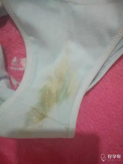 内裤上天天这样子,这是怎么了