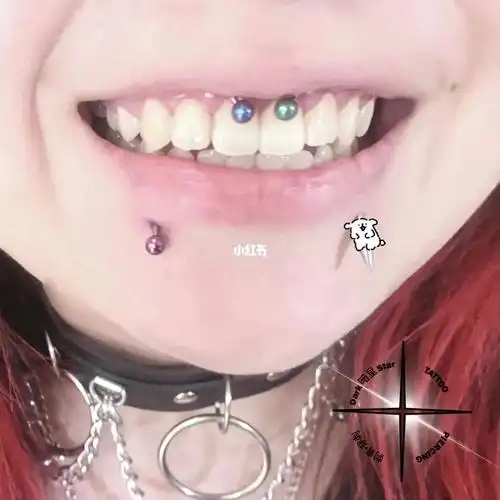 微笑钉-唇系带钉钉7716615被穿完微笑钉之后的笑容很很的灿烂