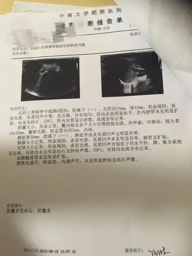 准备做试管婴儿,b超发现胆囊多发结石,最大19*10,请问能做不?