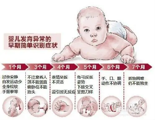 母婴/教育 育儿 > 婴儿期 3 单手握持仰卧儿童单侧膝部,脑瘫儿会用另