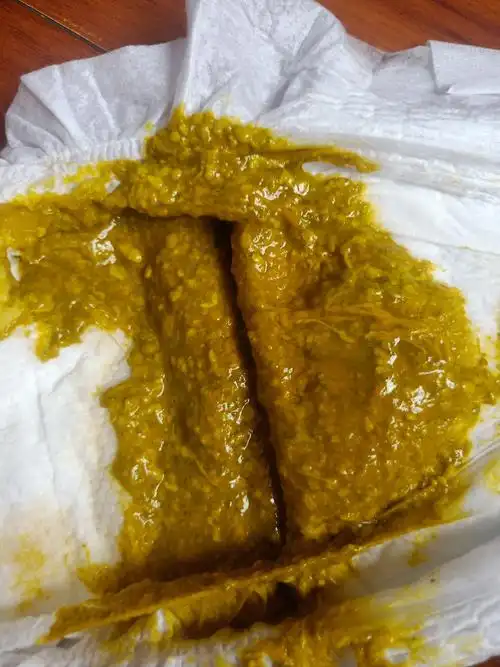 57天男宝宝大便有粘液,吐的奶也有透明粘液是怎么回事?