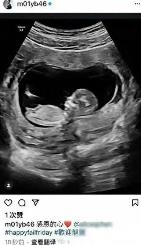 赖弘国晒b超照三婚怀二胎喜讯官宣_alice_宝宝_社交