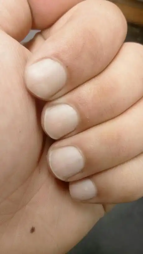 手指甲发白,求大神指点怎么回事?