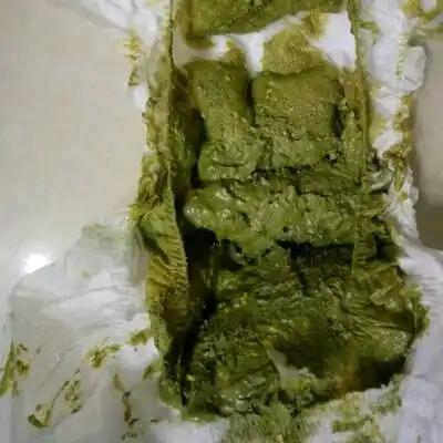 宝宝大便是绿色的怎么回事