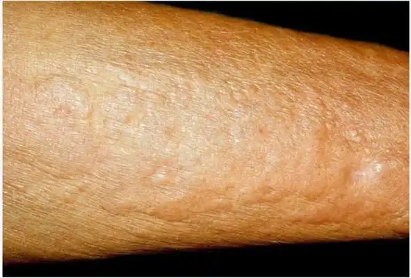 皮肤出现8种变化,离轰然倒下不远了,医生提醒:尽早检查,别拖