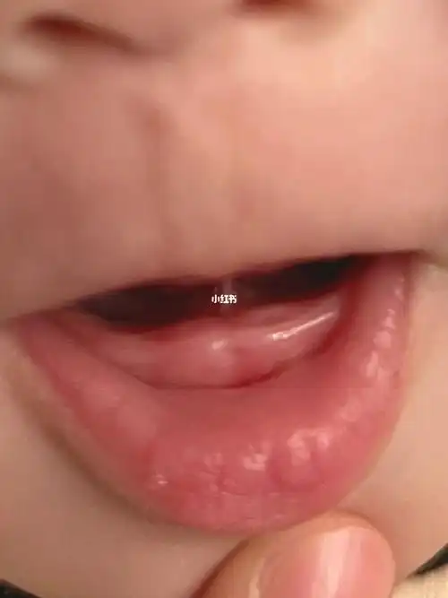 这是宝宝开始长牙了么