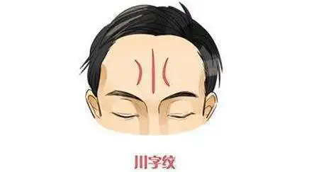 (以上之后面相上的说法)川字纹是一种正常的表情纹,随着年龄的增长