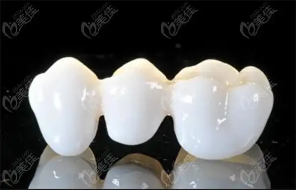 威兰德甄瓷选用进口原装锆块