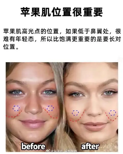 比起苹果肌的饱满度,它的位置和形态更重要,更影响颜值美观!