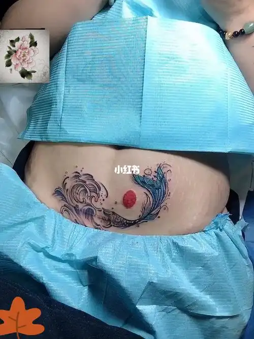 运城纹身剖腹产遮盖