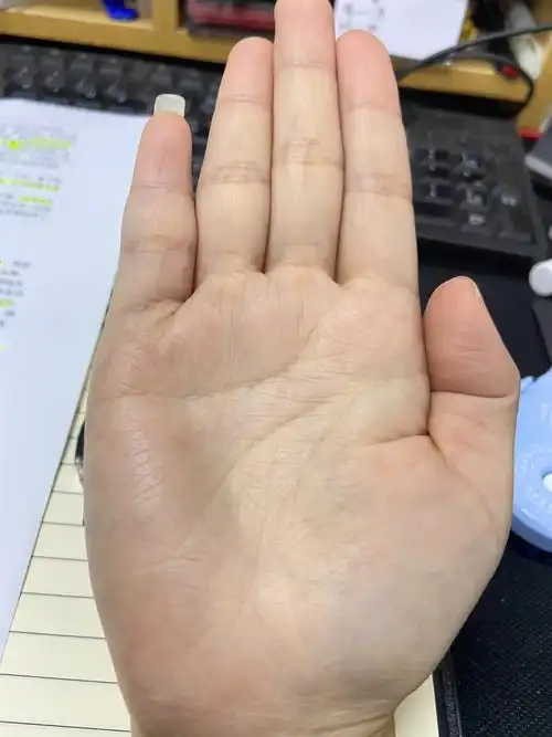 不知道什么时候多了这条竖的线,下面还有个岛纹,之前看的时候岛纹挺深