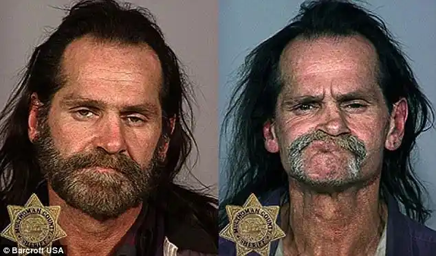 让人震惊的吸毒者前后对比照片声明:本组转载于英国《每日邮报》,照片