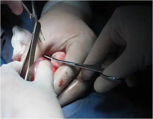 无精子症的常用活检方法有哪些?_睾丸