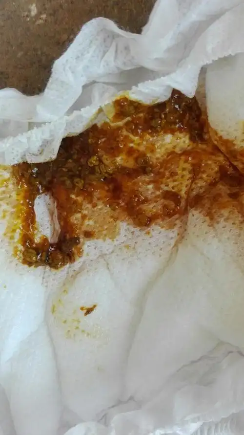 宝宝的大便好奇怪,急!