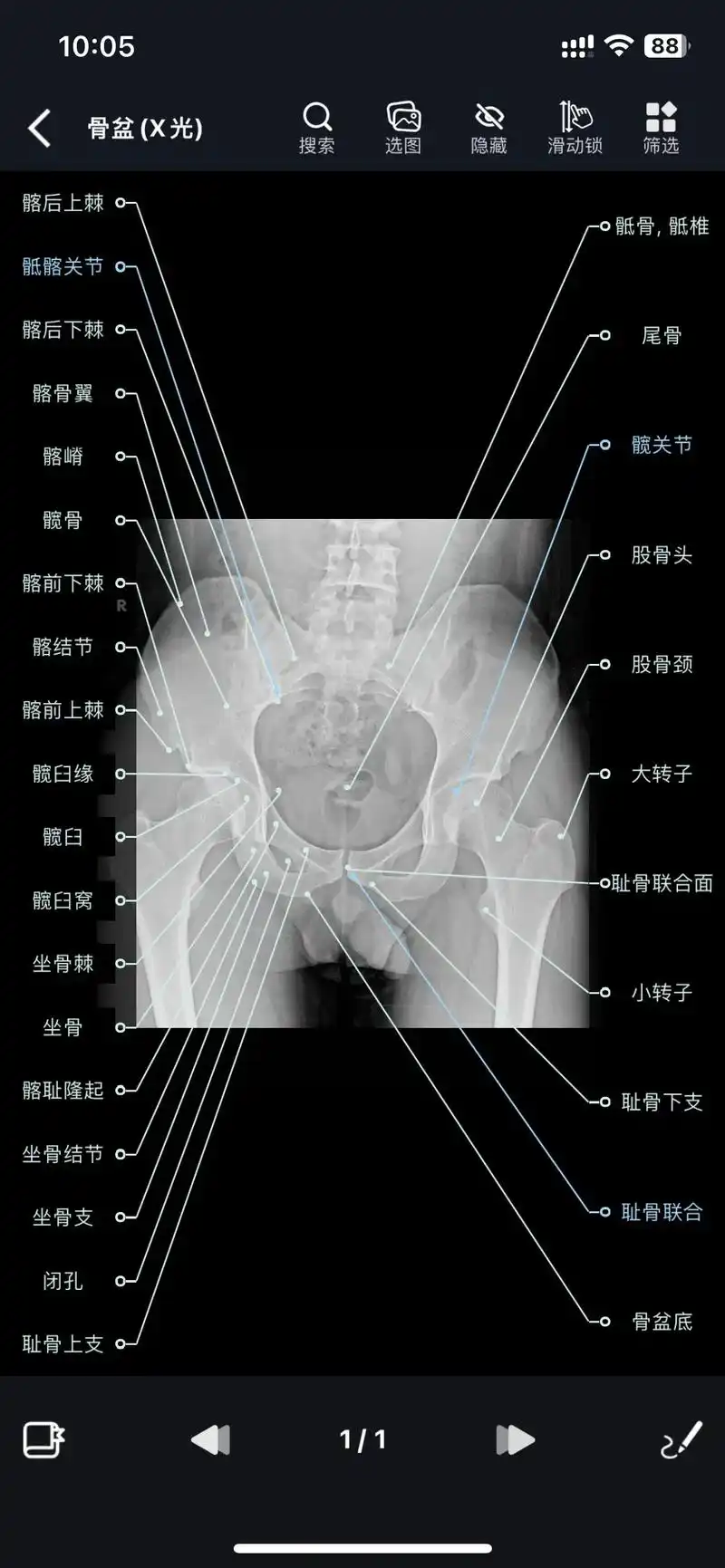 影像解剖图谱app #骨盆x光 #膝x光 #影 - 抖音