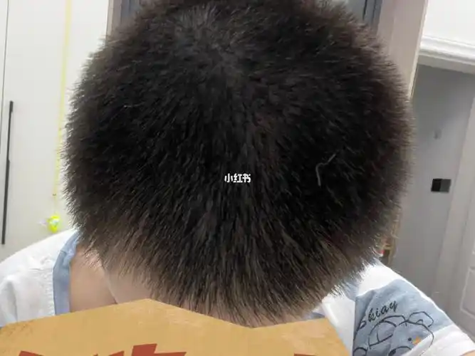 剃光头第三十天整