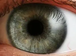 瞳孔如锯齿或梅花状