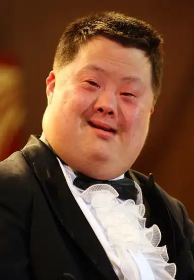 他智力残缺却能指挥乐队,21年前登上春晚爆红,现在生活如何?