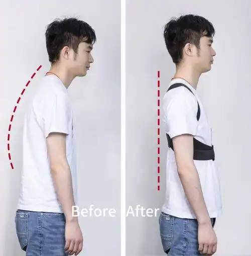 982听友福利社好物推荐丨驼背和不驼背的女生差距居然这么大