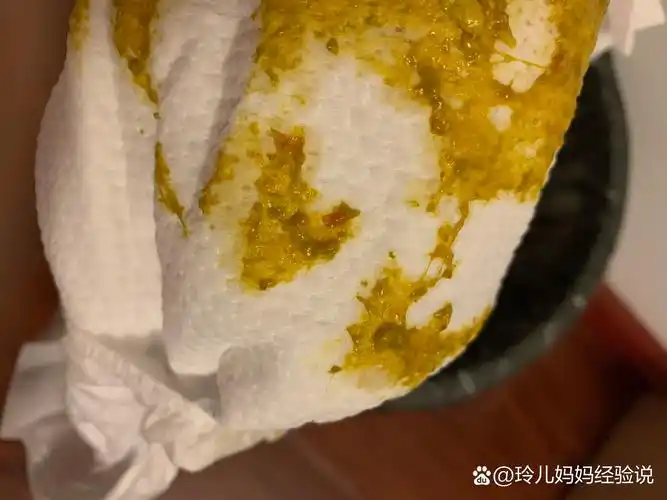 婴儿大便带粘液血丝(附图慎入) 97天的宝宝大便带奶瓣粘液,今天发现