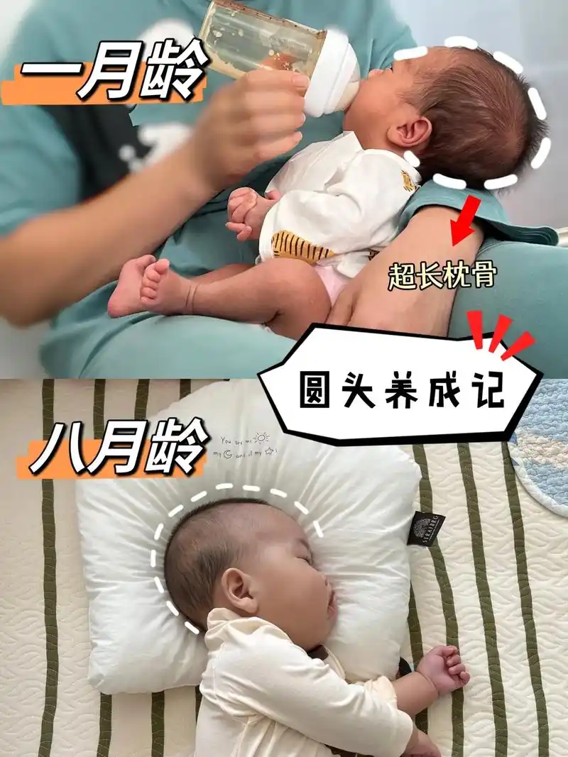 宝宝刚出生的时候,因为是顺产经过产道的挤压 - 抖音