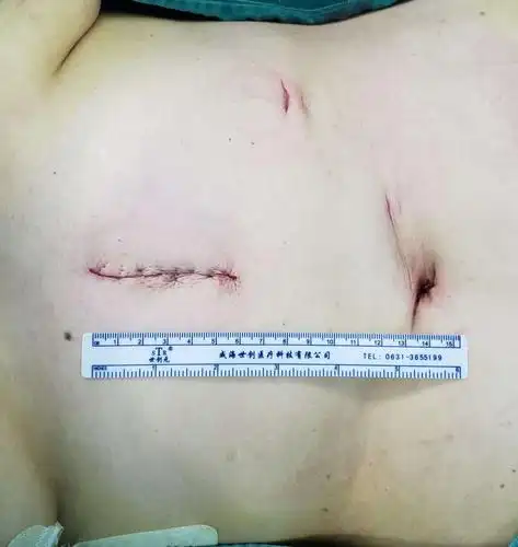 晋城大医院普外二病区周记 (20-10-5期)