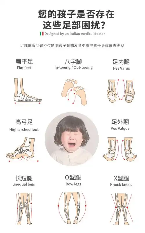 外八字儿童秋冬矫正鞋足外翻内翻宝宝扁平足纠正机能鞋外八内翻f1粉色
