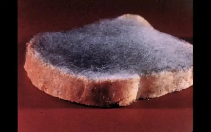 显微镜下的黑根霉(面包霉)