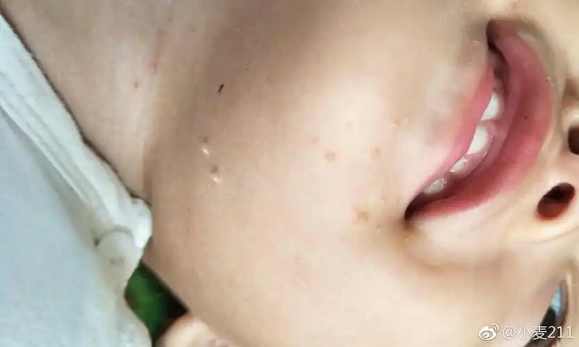 宝宝没有任何不正常的其它症状,精神状态 133人已围观,问题价值