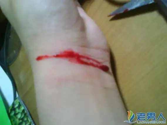 沈珂到底死了吗 揭ck沈珂死亡真相大量自残血腥照曝光 / 比乐族