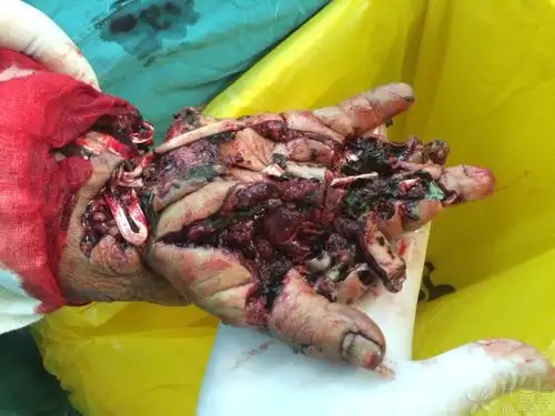 这个专科查体怎么写呢?