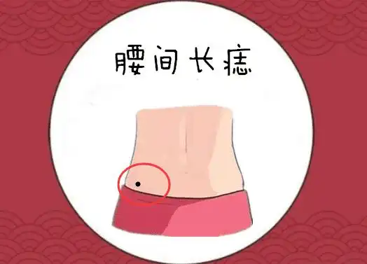 在一个人的腰间的位置处长有吉痣,则会有"腰缠万贯"的说法,往往以此处