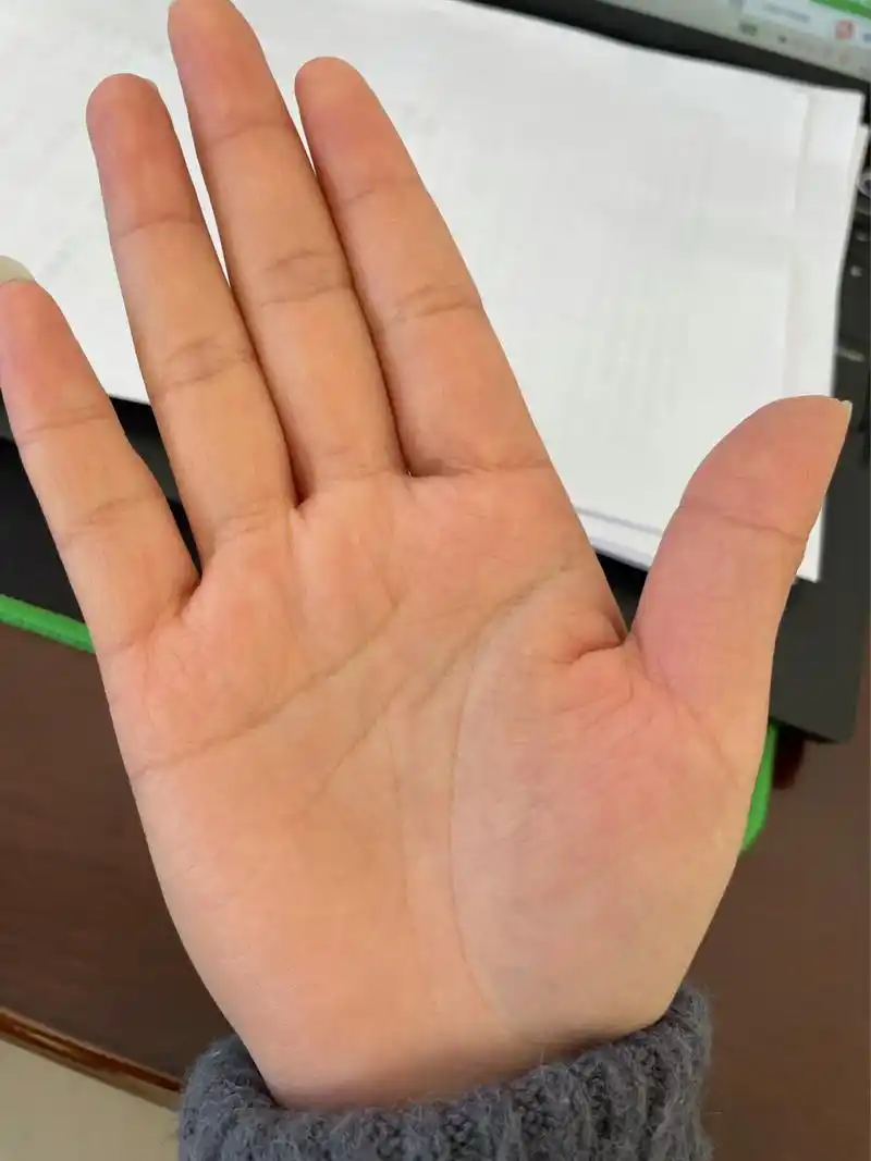 两个手掌掌纹,右手中间怎么断了. 右手掌中间那条线是断的么?