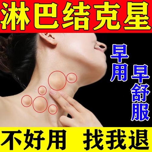 淋巴膏颈部通络淋巴结肿大散结消除贴去淋巴结副乳消除膏疏通神器