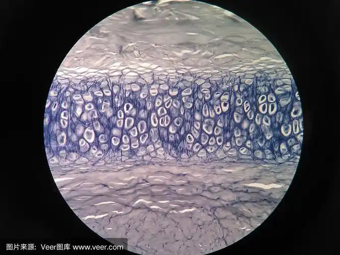 软骨,骨骼,在下面,横截面,显微镜