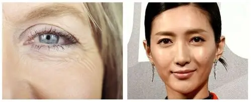 都是下垂眼,徐若瑄无辜可爱,江疏影俞飞鸿老气?