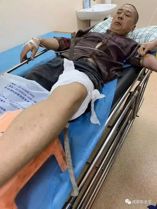 惊险80公分钢筋刺穿男子身体消防医生合力救他一命