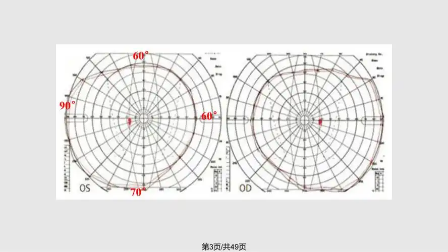 视野检查结果分析基础知识ppt课件ppt课件