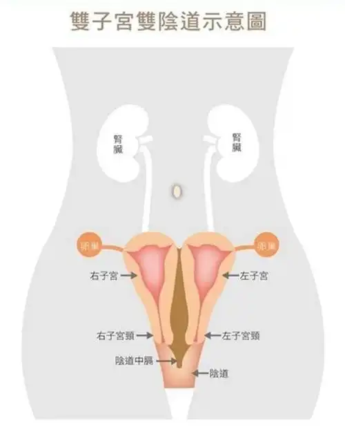 21岁女生意外检出两个阴道,还有双子宫?对身体有什么影响?