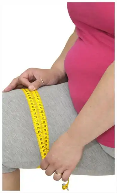 家族肥胖者,内分泌系统疾病等 粗胳膊,大象腿,大肚腩,水桶腰等.