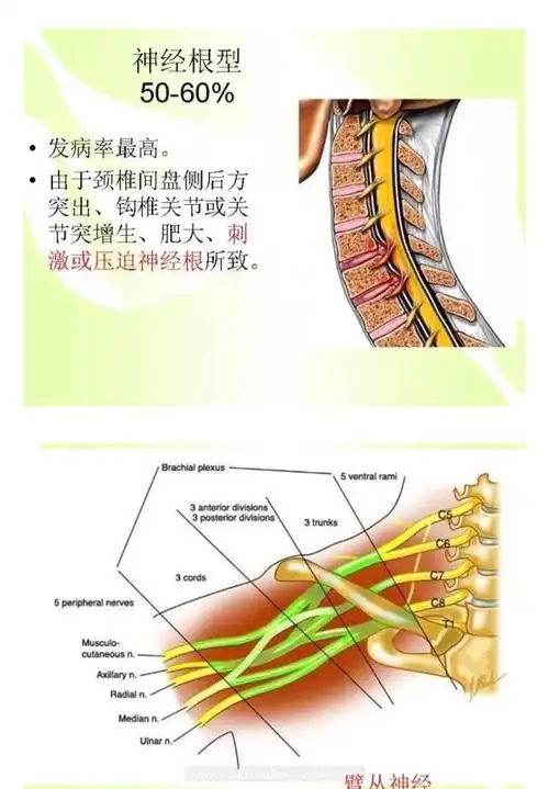颈椎病的病因,一目了然,图解析