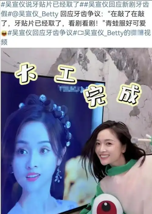 明星们花天价做的烤瓷牙最后却大都丑态百出