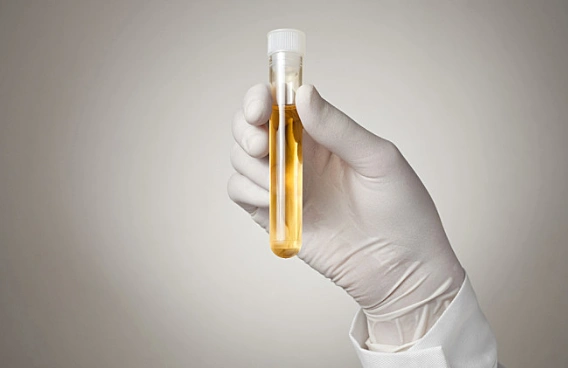 从奥运会尿检想到的