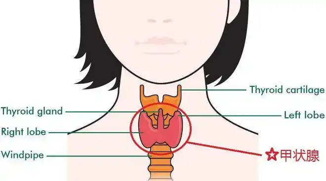 1. 甲状腺机能减退.甲状腺位于我们的脖子里,是一个蝴蝶形状的腺体.