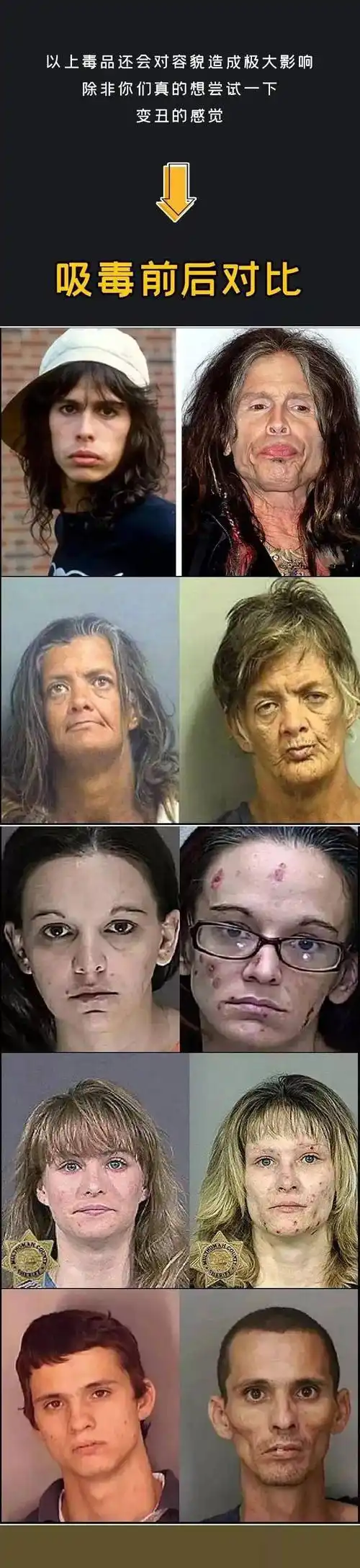 禁毒小课堂丨吸毒真的会变丑?一大波辣眼睛照片来袭!