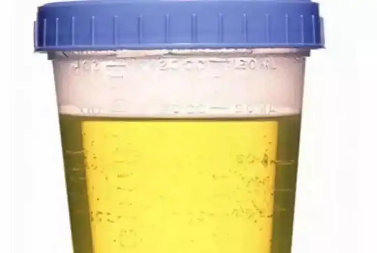 童子尿到底能不能治病?