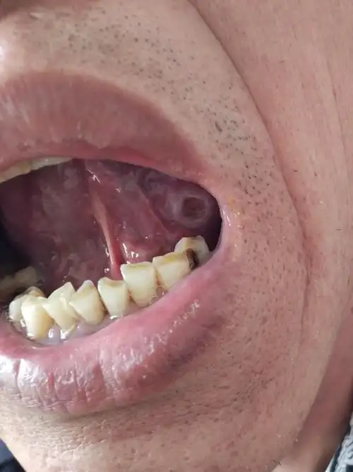 舌头上边这是什么