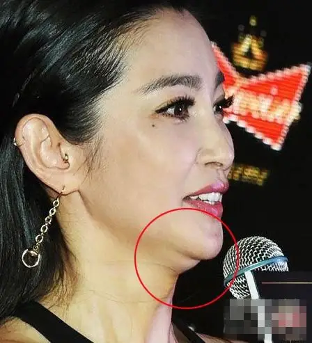 太胖了还是整毁了?全智贤霍思燕高颜值美女惊现双下巴