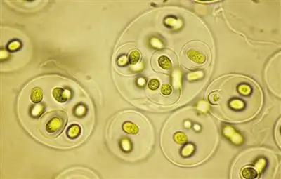 海平面以下1500米,海底黑烟囱周围,生活着一种古老的光合细菌, 它能否